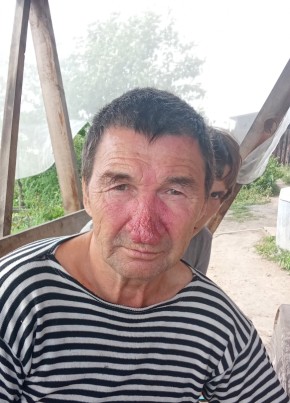 Владимир из Усть-Илимска 63 года