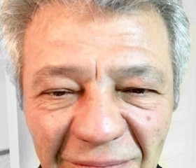Yakup, 63 года, Λευκωσία