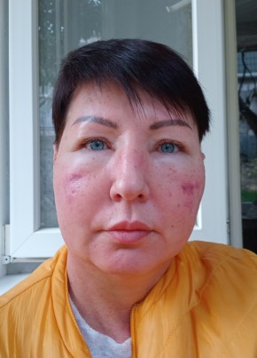 Покасекрет из Ялты 51 год