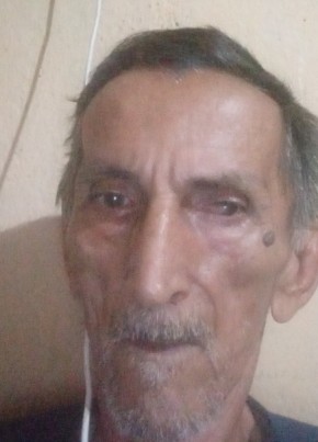 Sousa из Sobral 64 года
