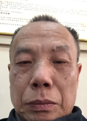 张麒, 62, 中华人民共和国, 北京市