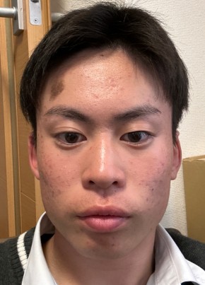 れんと, 19, 日本, 八尾市