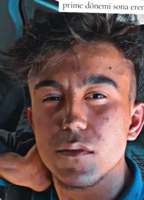 Can sikici, 19, Turkey, Corlu