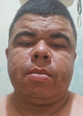 Giliarde из Açu 29 лет