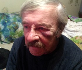 Хуевка, 83 года, Арбаж