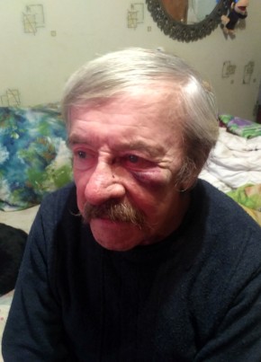 Хуевка, 83, Россия, Арбаж