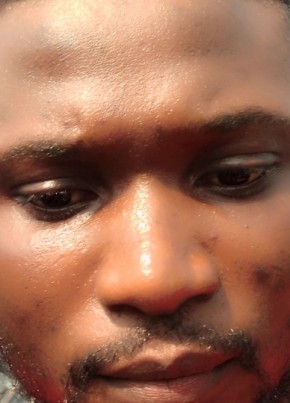Nkembeng Anderso, 31, Republic of Cameroon, Yaoundé