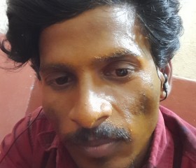 Tony, 29 лет, Hyderabad