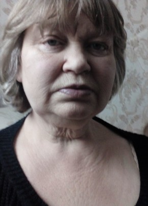 Валя, 58, Россия, Юхнов