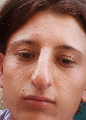 عمر, 20, Syria, Aleppo