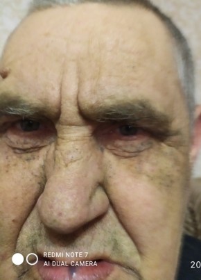 Николай, 70, Россия, Новозыбков