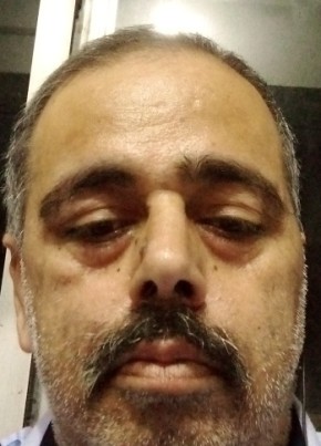 Sunil Kapur, 49, India, Ludhiana