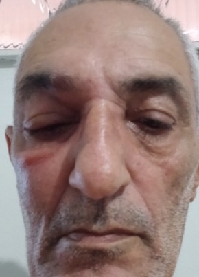 Francisco из Fernandópolis 62 года