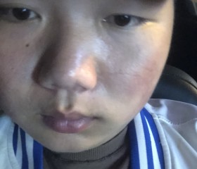 y亿, 21, Enshi
