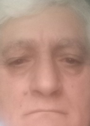 Гнел из Саратова 63 года