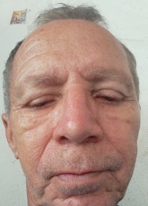 Jacinto bezerra из Uruaçu 60 лет