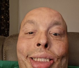 Mark, 18, Chicago