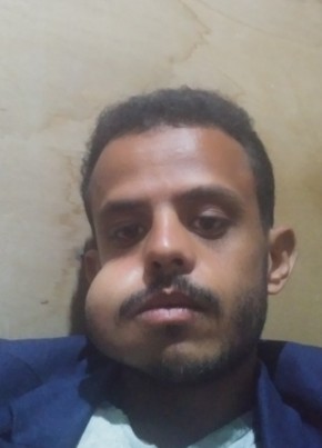 احمد.بشير.محمد.غ, 24, الجمهورية اليمنية, صنعاء
