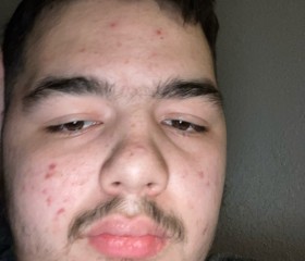 Chase, 19, Dallas