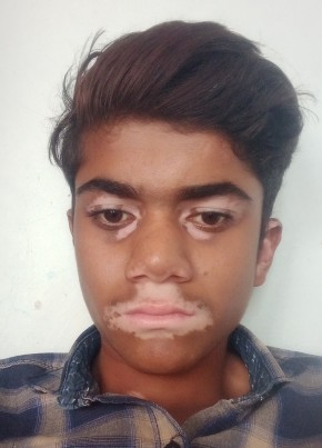 Manjunath, 19, India, Mudgal