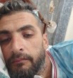 Bilal