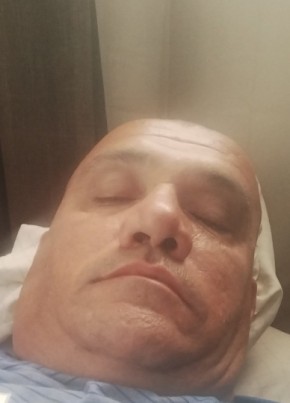 Errr, 18, United States of America, Anaheim