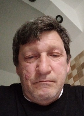 RADU